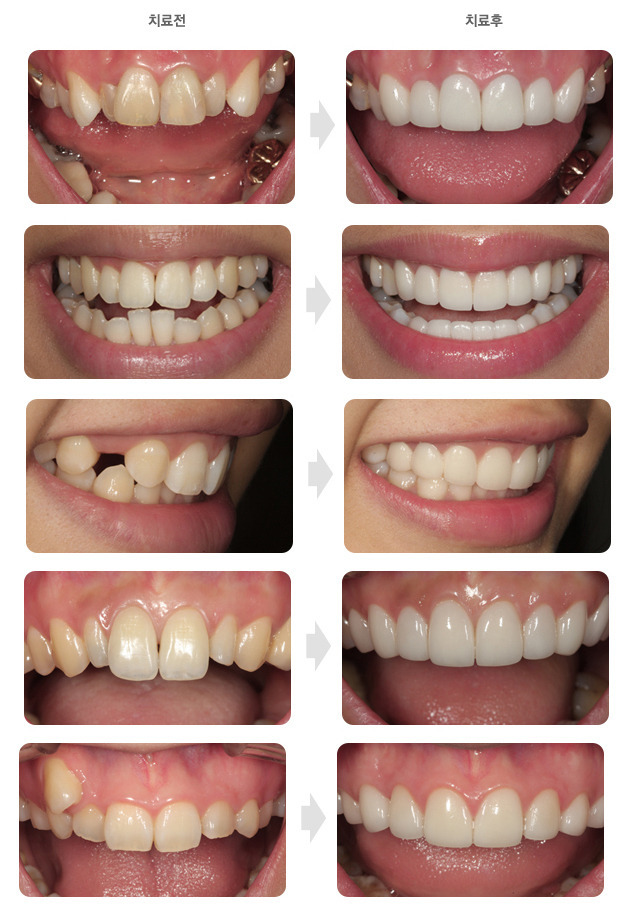 연예인들이 이걸 많이 하는 이유.jpg | 인스티즈
