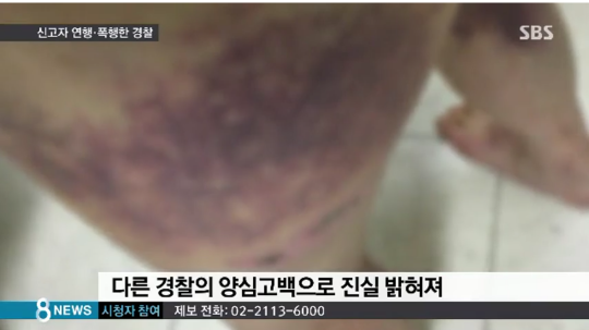 경찰이 신고한 시민을 폭행한 이유는?? | 인스티즈