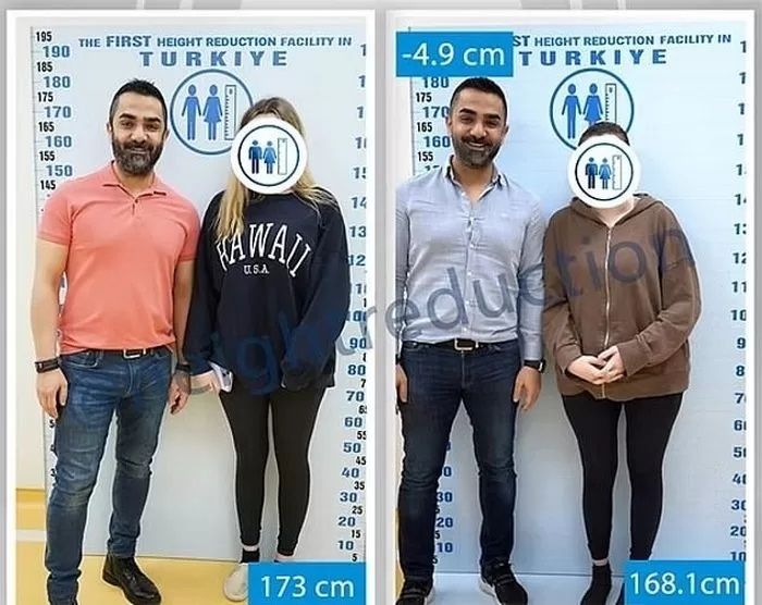 "남친 사귀고 싶어서"..극심한 고통 참고 '이 수술' 받는 여성들 [헬스톡] | 인스티즈