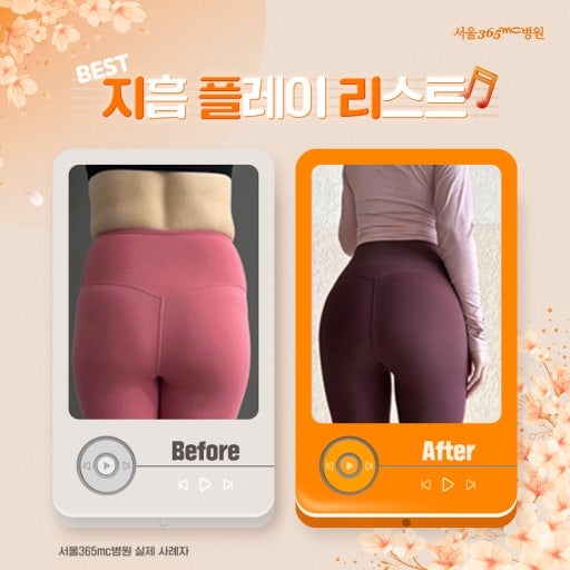 허파고리가 무슨 뜻인지 알아?? | 인스티즈