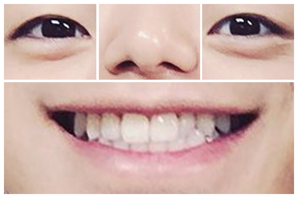 눈코입보고 어느연예인인지 알아내기 | 인스티즈