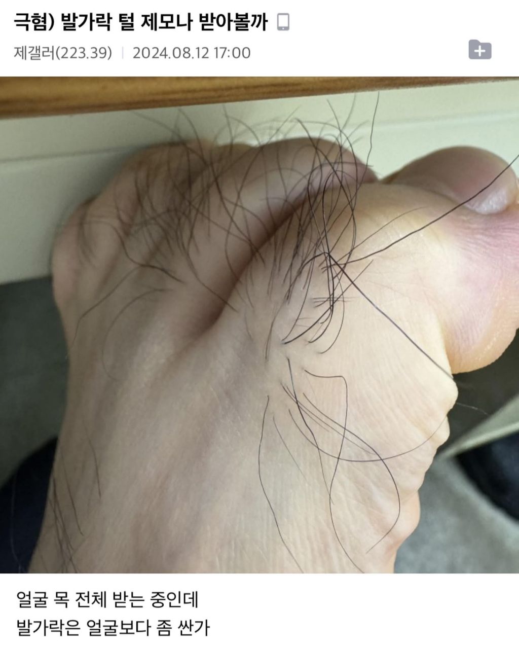 발가락 털 제모나 받아볼까 | 인스티즈