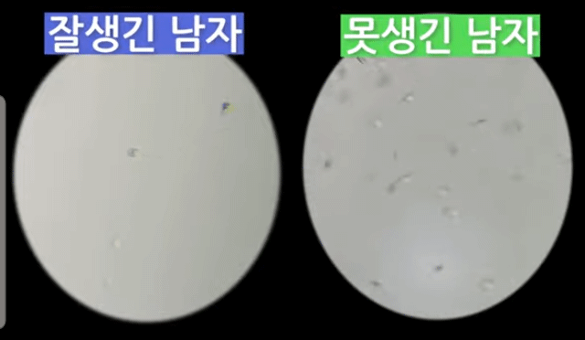 못생긴 남자는 번식의 기회가 적어 적은 교미로 임신을 시켜야 하기 때문에 정자 움직임이 더 많다고 함 | 인스티즈