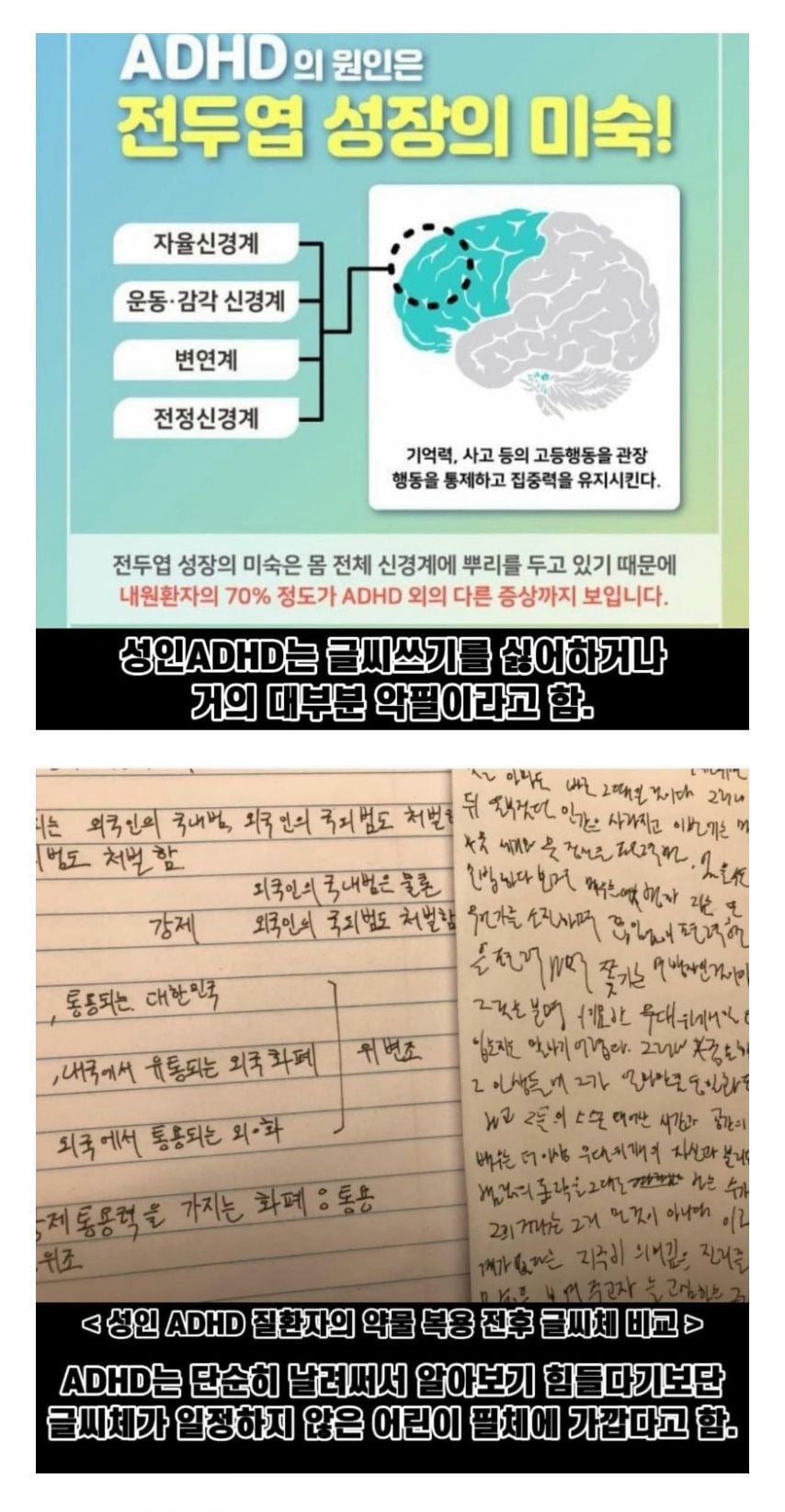성인 ADHD 환자들의 필체 | 인스티즈