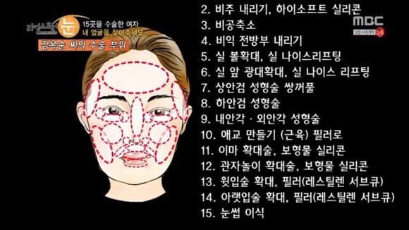 [리얼스토리눈] 15곳을 수술한 여자 내 얼굴을 찾아주세요 (성형수술 부작용) | 인스티즈