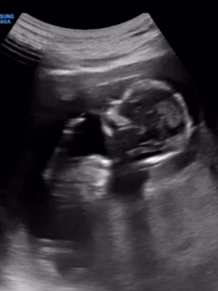 전 KBS 기상캐스터 강아랑 인스타 | 인스티즈