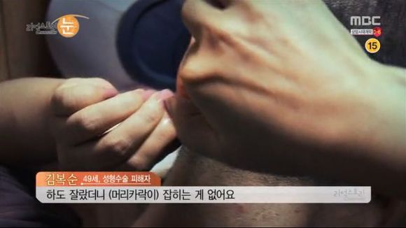 [리얼스토리눈] 15곳을 수술한 여자 내 얼굴을 찾아주세요 (성형수술 부작용) | 인스티즈