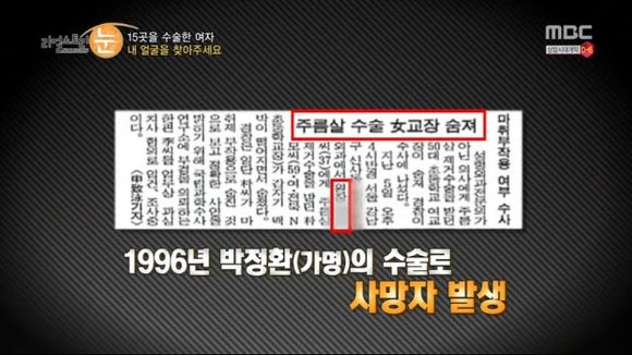 [리얼스토리눈] 15곳을 수술한 여자 내 얼굴을 찾아주세요 (성형수술 부작용) | 인스티즈
