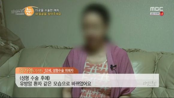[리얼스토리눈] 15곳을 수술한 여자 내 얼굴을 찾아주세요 (성형수술 부작용) | 인스티즈