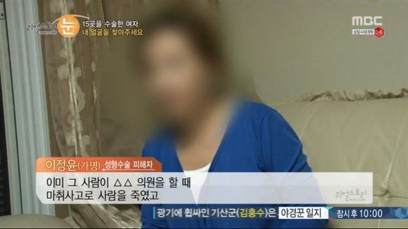 [리얼스토리눈] 15곳을 수술한 여자 내 얼굴을 찾아주세요 (성형수술 부작용) | 인스티즈