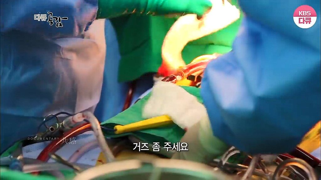 흉부외과 의사가 수술할때 화를 내는 이유 | 인스티즈