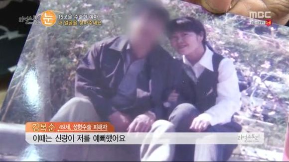 [리얼스토리눈] 15곳을 수술한 여자 내 얼굴을 찾아주세요 (성형수술 부작용) | 인스티즈