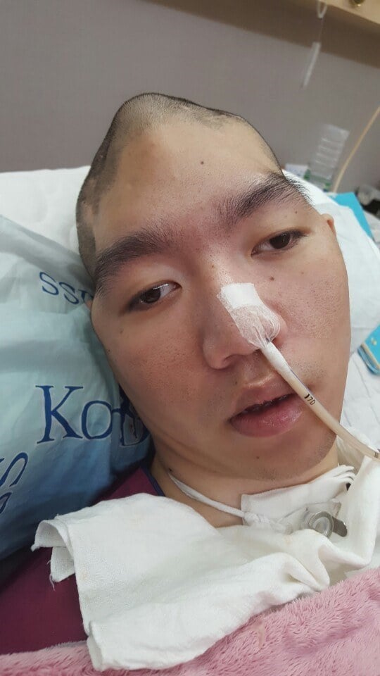 도와주세요..식물인간이된 친구 | 인스티즈
