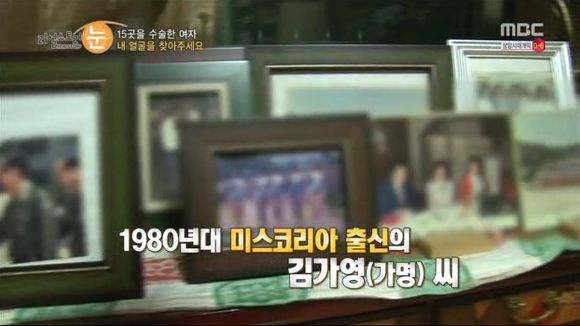 [리얼스토리눈] 15곳을 수술한 여자 내 얼굴을 찾아주세요 (성형수술 부작용) | 인스티즈