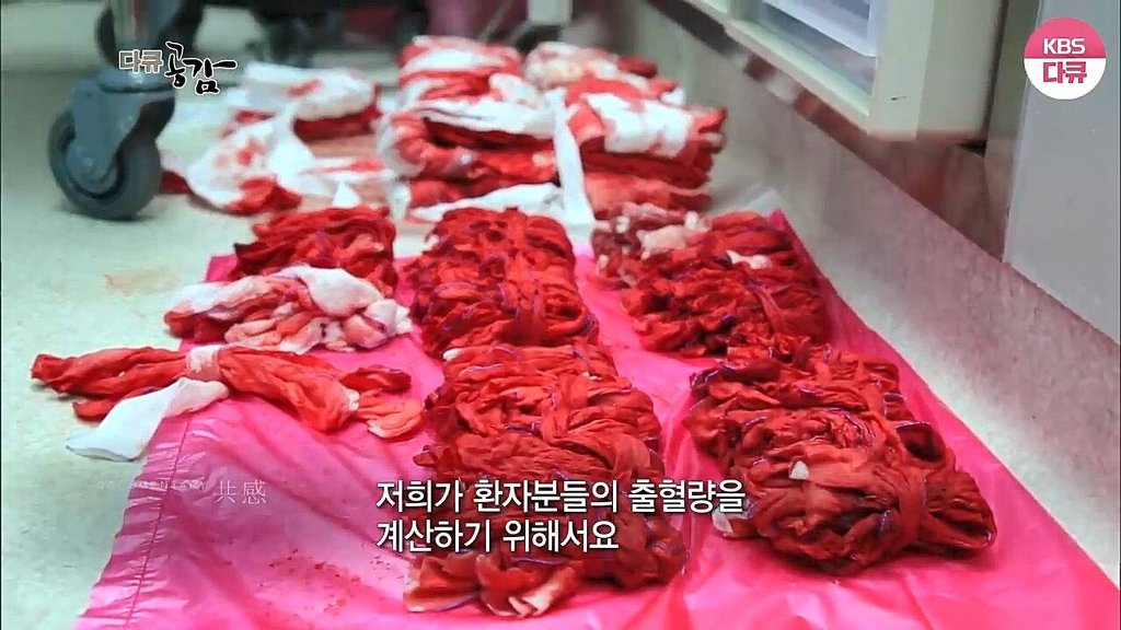 흉부외과 의사가 수술할때 화를 내는 이유 | 인스티즈