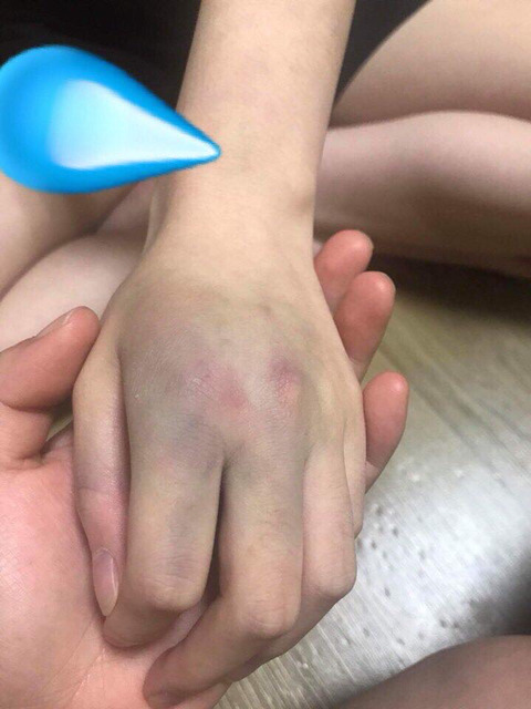 내 지인이 남자친구한테 폭력당했어 좀 도와줘 ((페이스북)) | 인스티즈