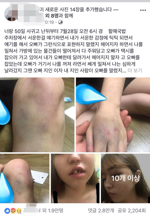 내 지인이 남자친구한테 폭력당했어 좀 도와줘 ((페이스북)) | 인스티즈