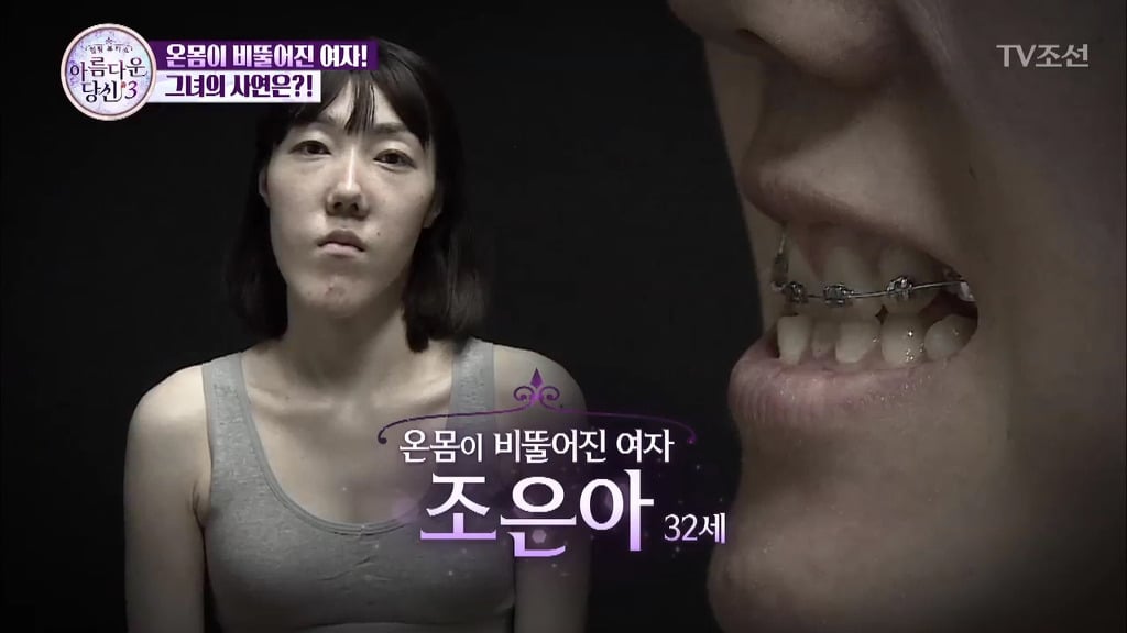 부정교합을 방치하면 안되는 이유 | 인스티즈