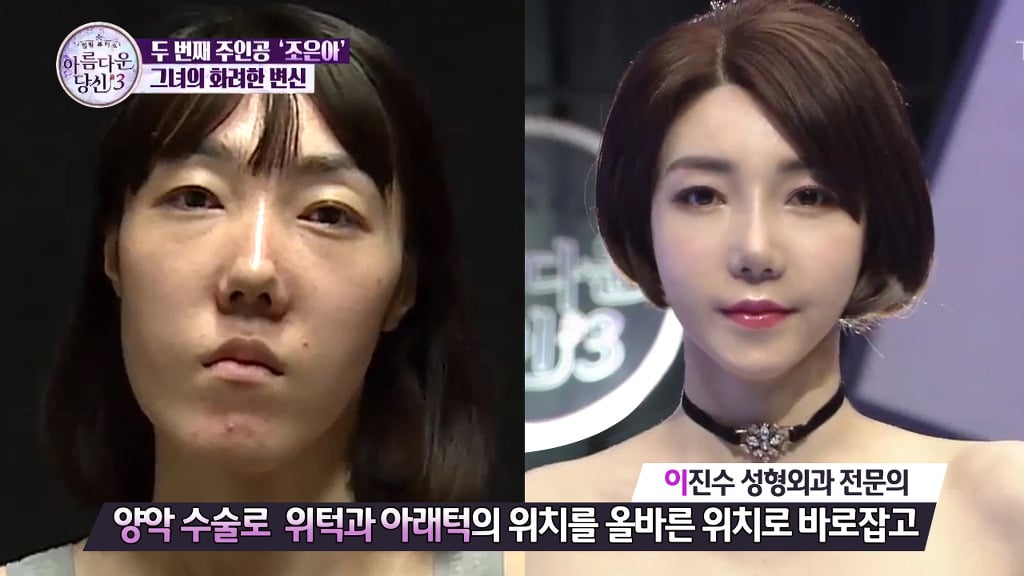 부정교합을 방치하면 안되는 이유 | 인스티즈