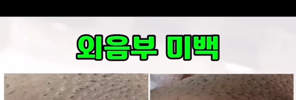 외모 정병 max_최종_최최종_최최최최종_아진짜이번이마지막최종 | 인스티즈