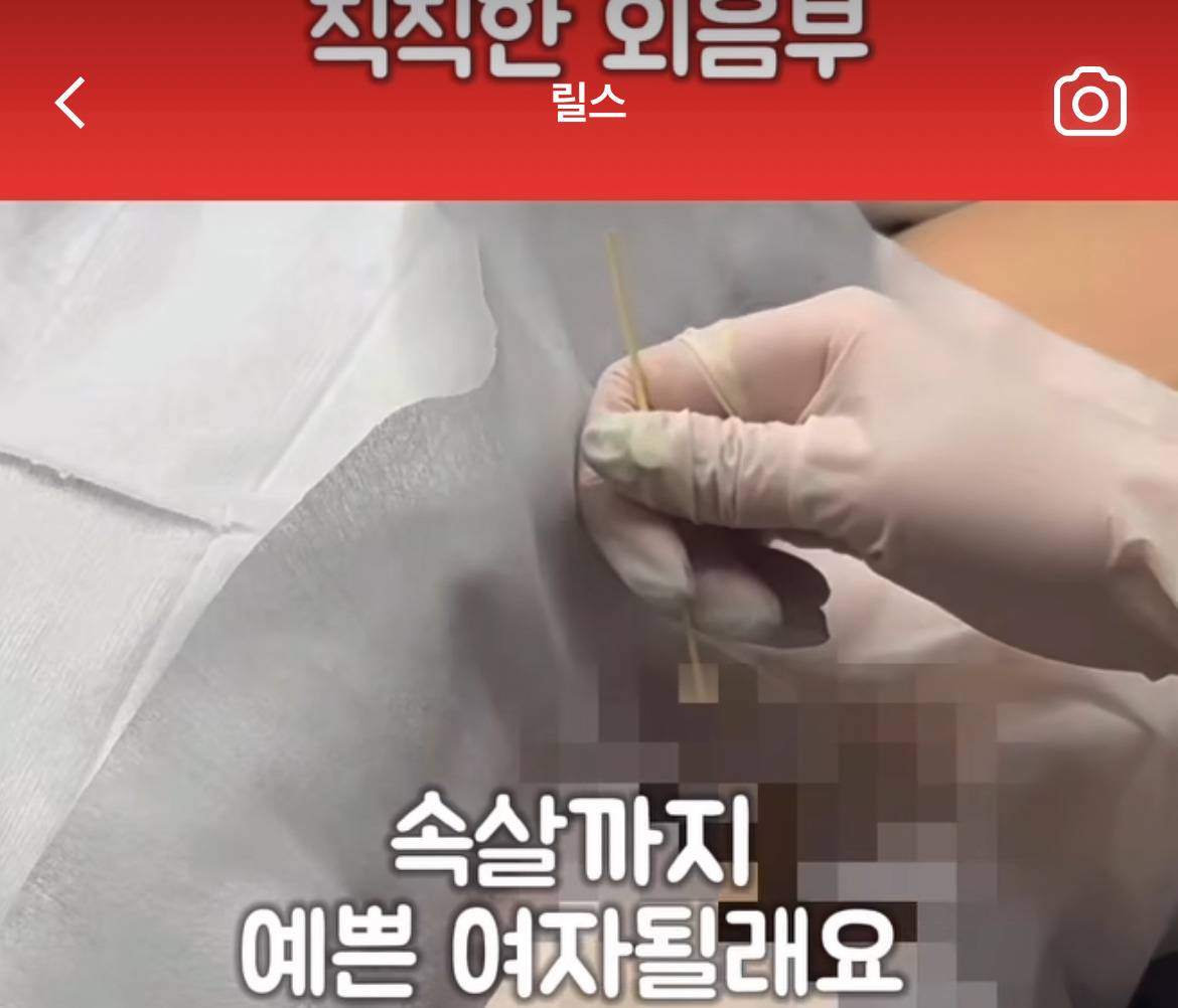 외모 정병 max_최종_최최종_최최최최종_아진짜이번이마지막최종 | 인스티즈