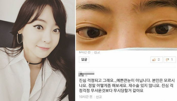 '눈 앞트임 성형 의혹'에 자신의 희귀병 고백한 서유리 | 인스티즈