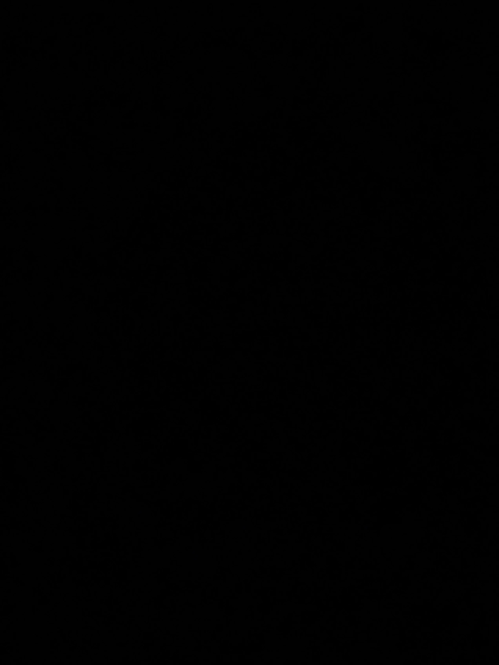 형아! 나 드디어 눈 기증 받게 됐대! | 인스티즈