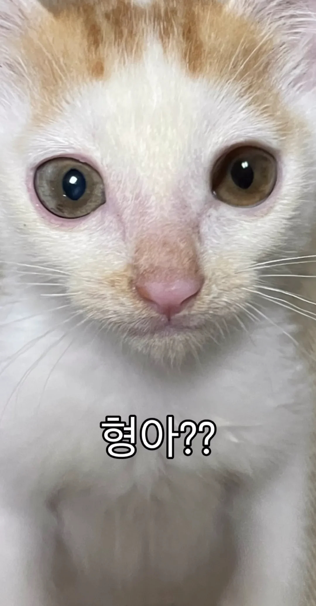 형아! 나 드디어 눈 기증 받게 됐대! | 인스티즈