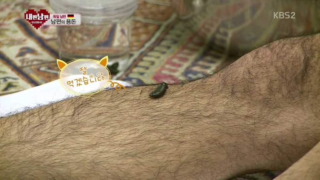 흔한 독일인의 민간요법 | 인스티즈