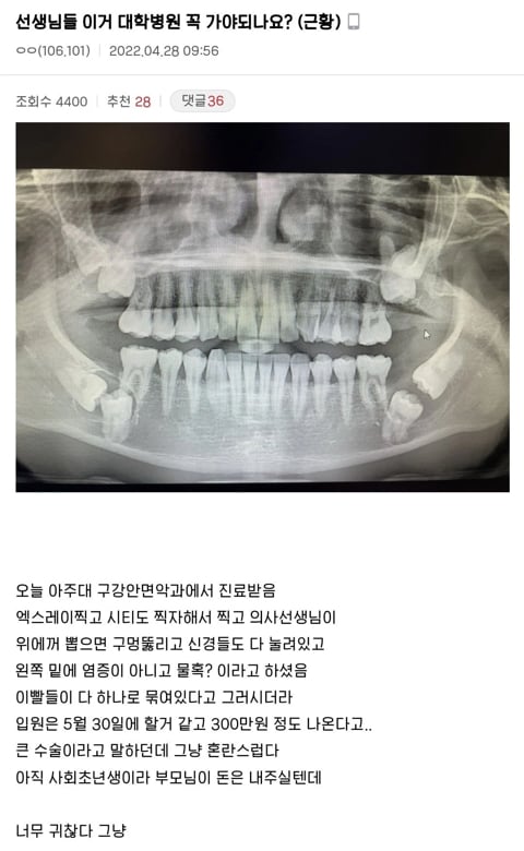 선생님들 이거 대학병원 꼭 가야하나요? 역대급 사랑니 수술후기 | 인스티즈