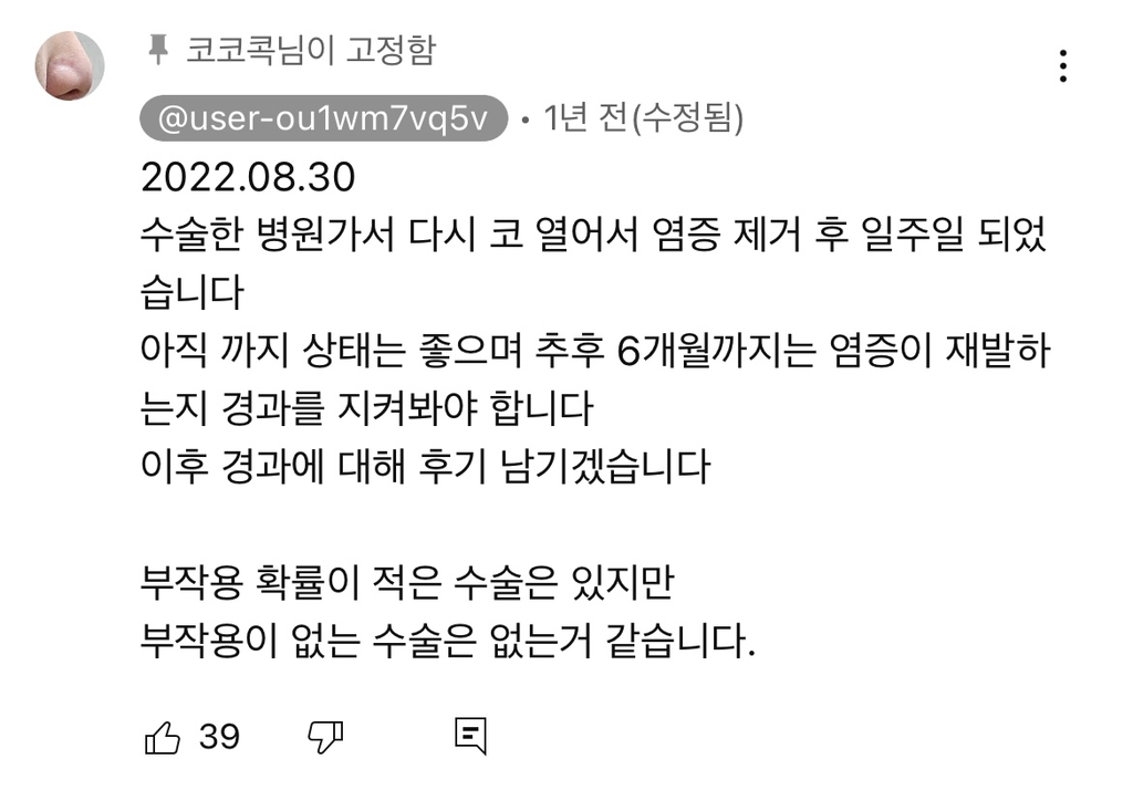 코수술 부작용으로 인한 코끝 꺼짐 + 자가진피 코수술 후기 | 인스티즈