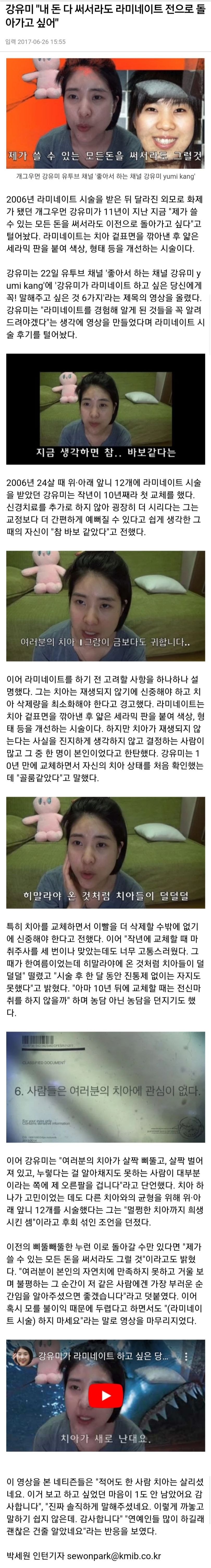 요즘 연예인들이 하는 치아 시술 | 인스티즈