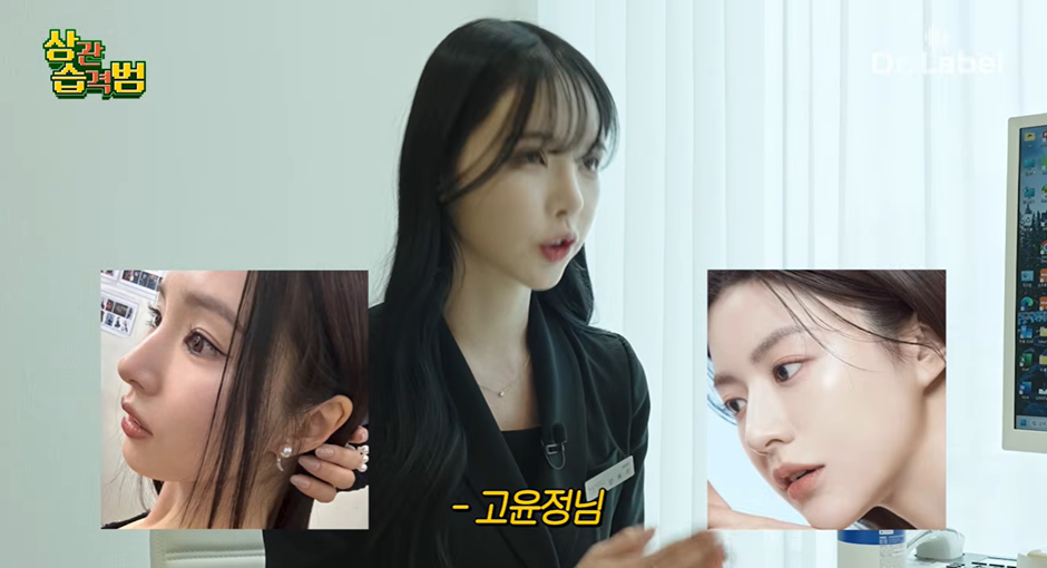 절대 화려하게 높이 세우지 않는다는 요즘 코 수술 트렌드 | 인스티즈