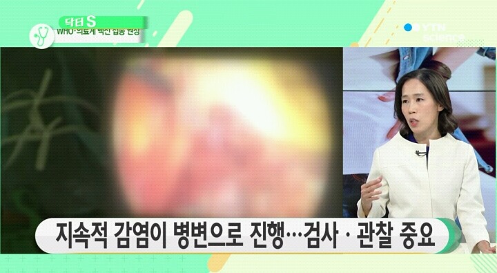 자궁경부암의 전조증상.jpg | 인스티즈