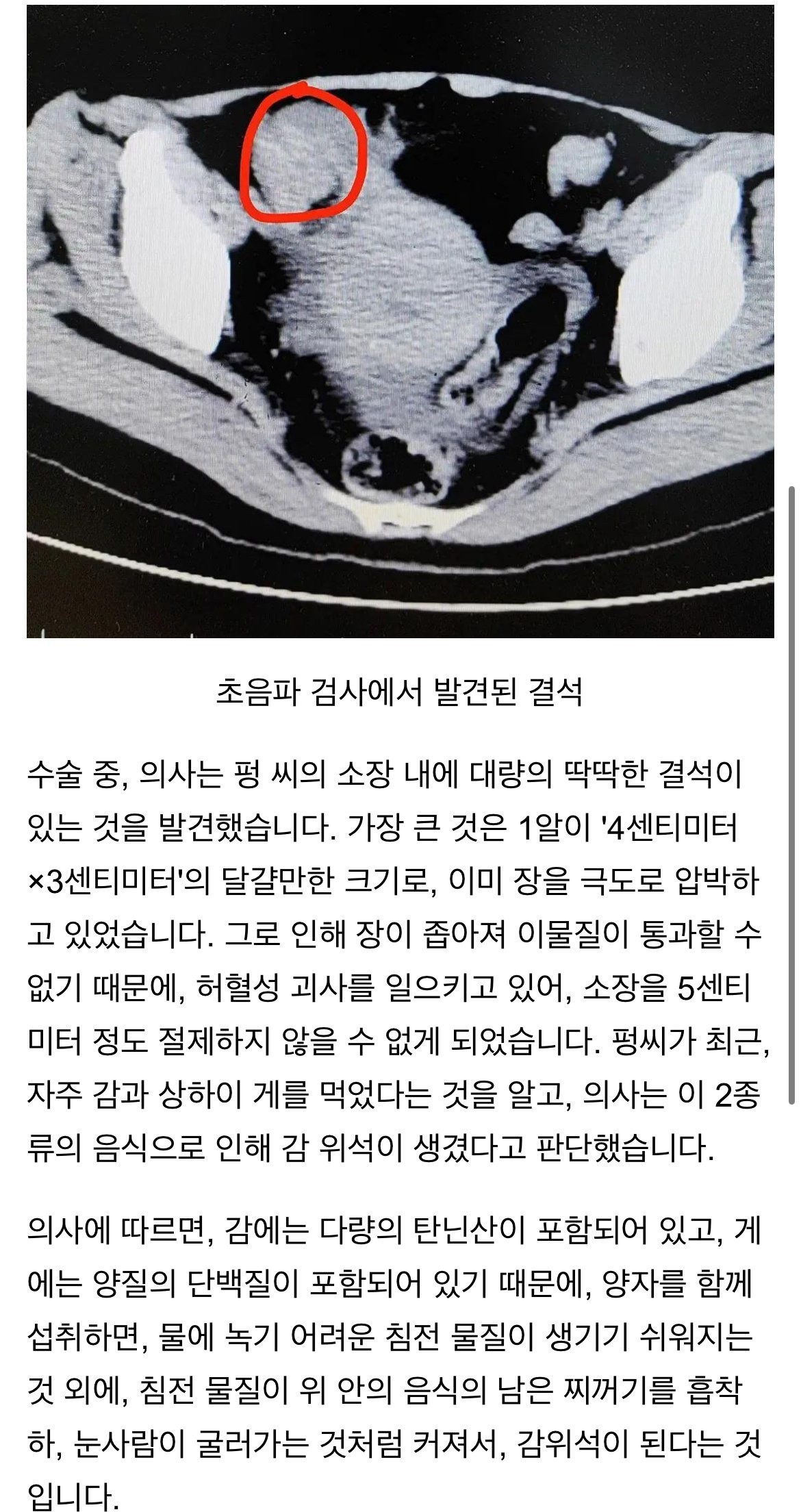 300년 만에 실제로 검증된 음모론 | 인스티즈