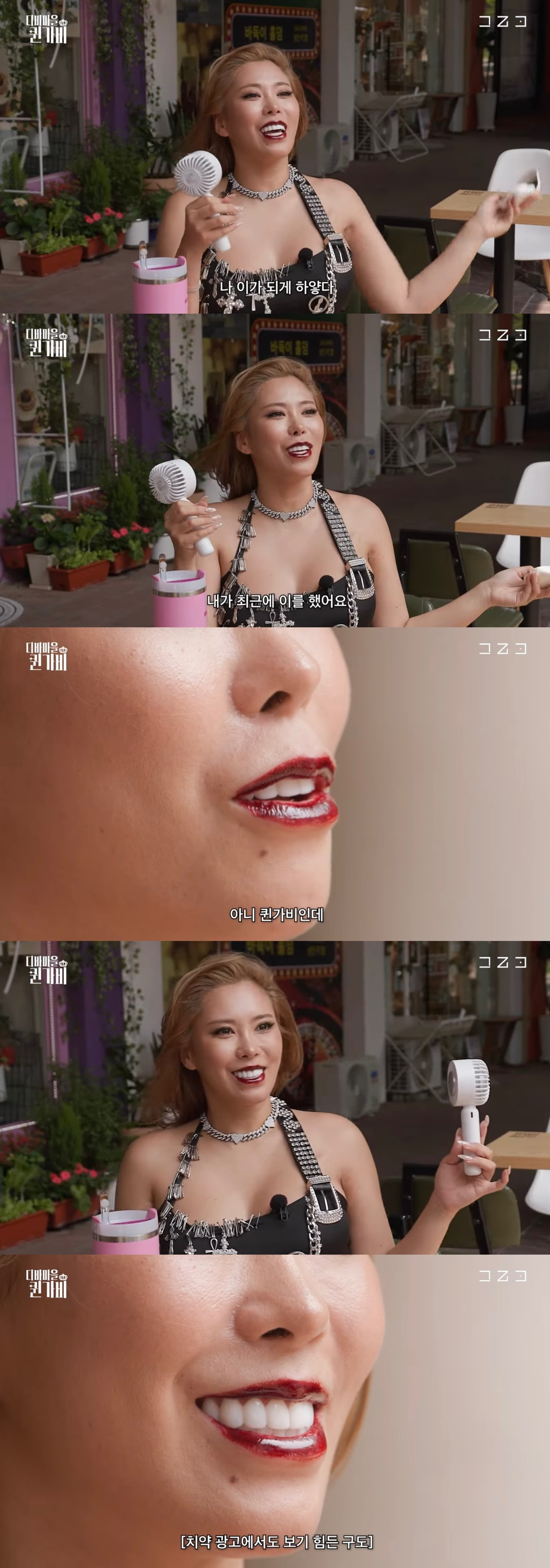 요즘 연예인들이 하는 치아 시술 | 인스티즈