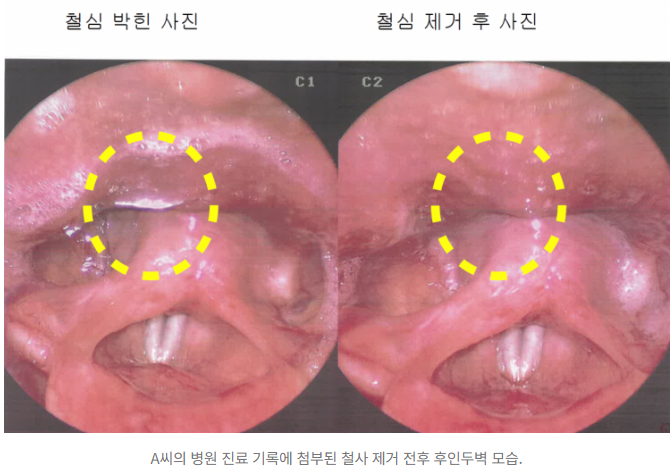 60계치킨 '철사 혼입' 사건 가맹점주 상대 소송 첫 재판 열려 | 인스티즈