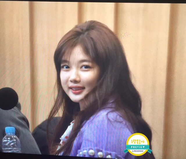 사랑니 빼서 얼굴이 부었다는 김유정 | 인스티즈