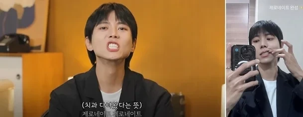 요즘 연예인들이 하는 치아 시술 | 인스티즈