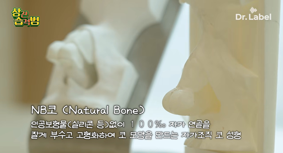 절대 화려하게 높이 세우지 않는다는 요즘 코 수술 트렌드 | 인스티즈