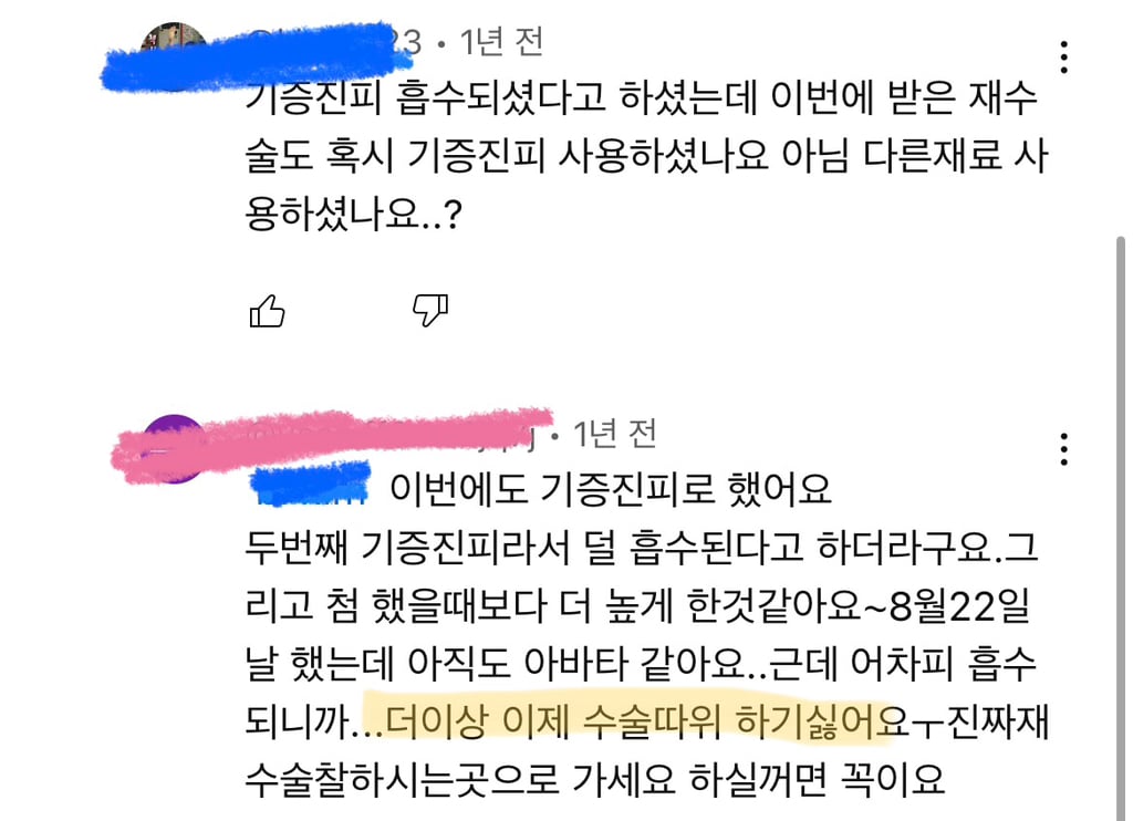 코수술 부작용으로 인한 코끝 꺼짐 + 자가진피 코수술 후기 | 인스티즈