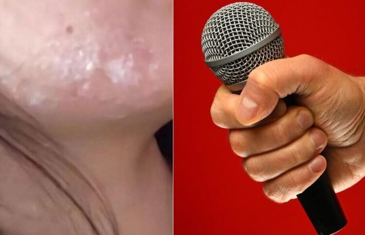 "물집이 코, 뺨에도”…노래방서 '이것' 감염돼 8년째 고통받는 女, 무슨 일? | 인스티즈