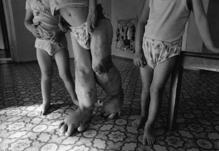 핵 그리고 방사능 피해자들 | 인스티즈