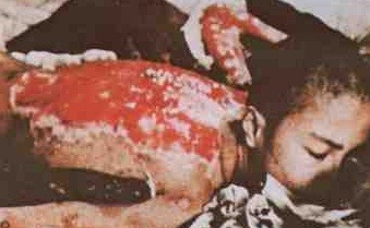 핵 그리고 방사능 피해자들 | 인스티즈