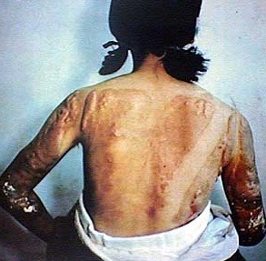 핵 그리고 방사능 피해자들 | 인스티즈