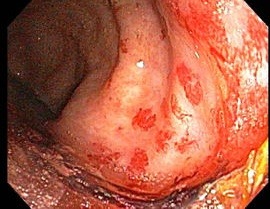 핵 그리고 방사능 피해자들 | 인스티즈