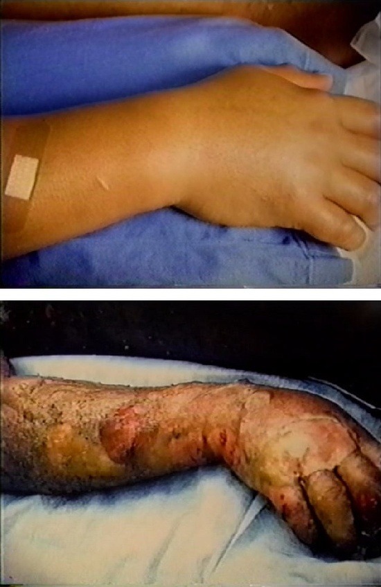 핵 그리고 방사능 피해자들 | 인스티즈