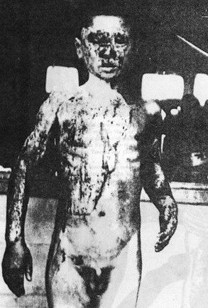 핵 그리고 방사능 피해자들 | 인스티즈