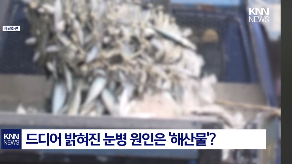 염증 생기더니..."앞이 안 보여요?" 중국발 미스테리 눈병 확산 패닉' | 인스티즈