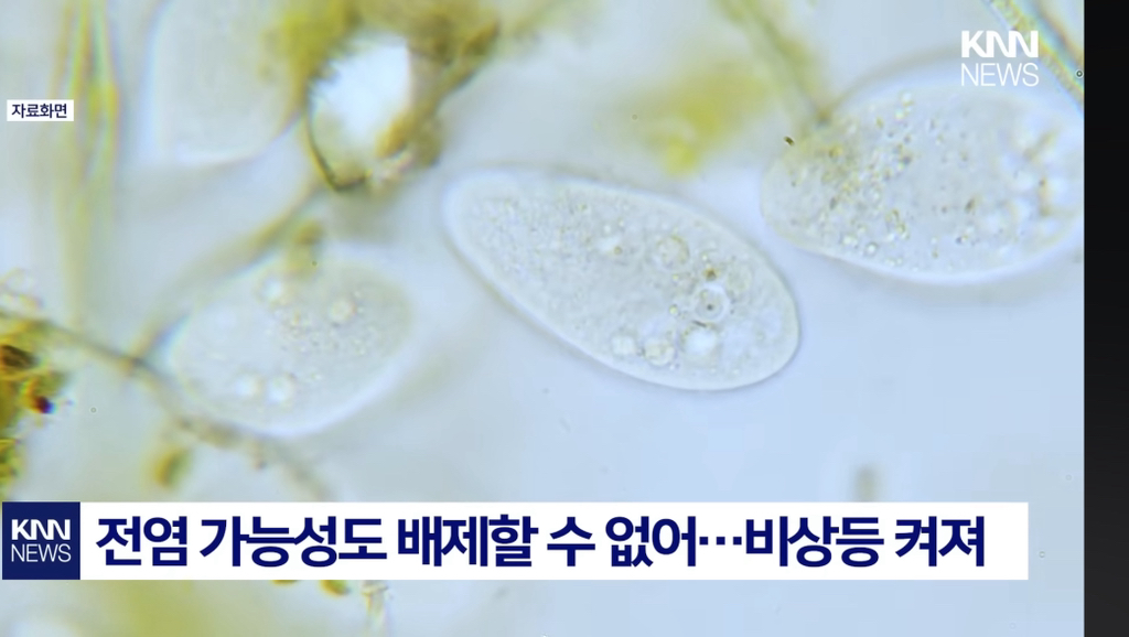 염증 생기더니..."앞이 안 보여요?" 중국발 미스테리 눈병 확산 패닉' | 인스티즈